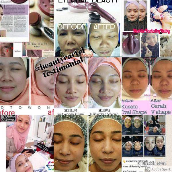 Mobile Home Facial Service - image 2