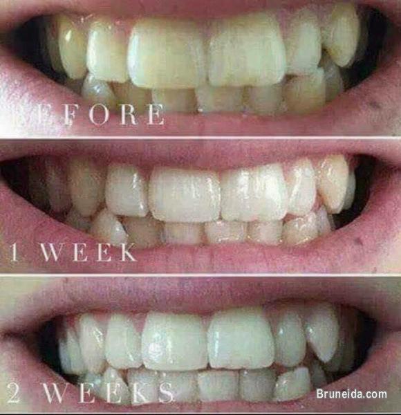 Ap24 Whitening Toothpaste - image 4