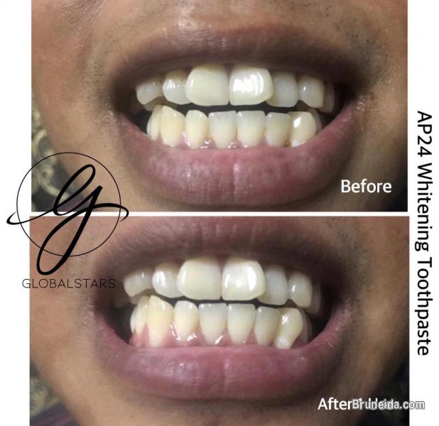 Ap24 Whitening Toothpaste - image 5