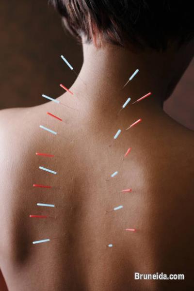ACCUPUNCTURE AND HOMEPOTHY HEALTH CENTRE 8608625 - image 2